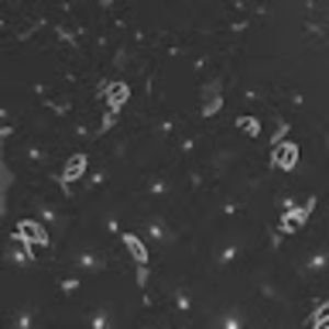 Meet your Posher, Casey